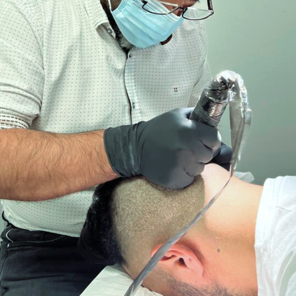 Haarpigmentierung (SMP)